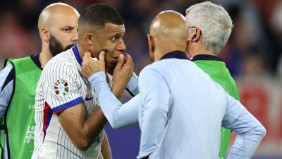 Евро-2024: Килиан Мбаппе получил травму в своём первом матче в Германии