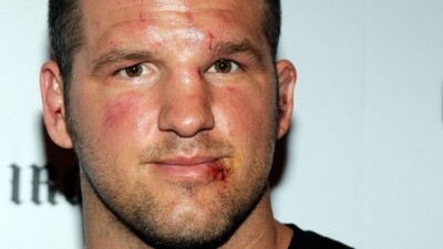 Глухой от рождения экс-боец UFC обрёл слух