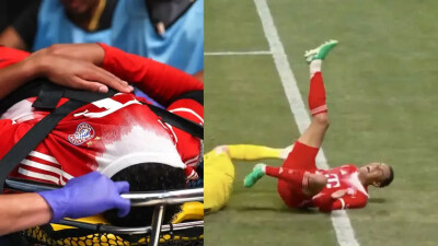 Агент Доннаруммы высказался о тяжёлой травме Мусиалы, нанесённой голкипером ПСЖ