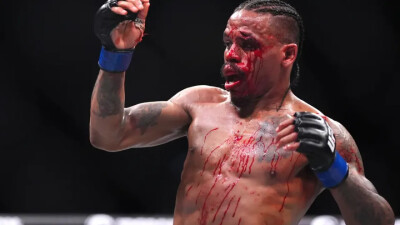 Американский боец чуть не потерял зрение после ужасного рассечения, но удивил фанатов